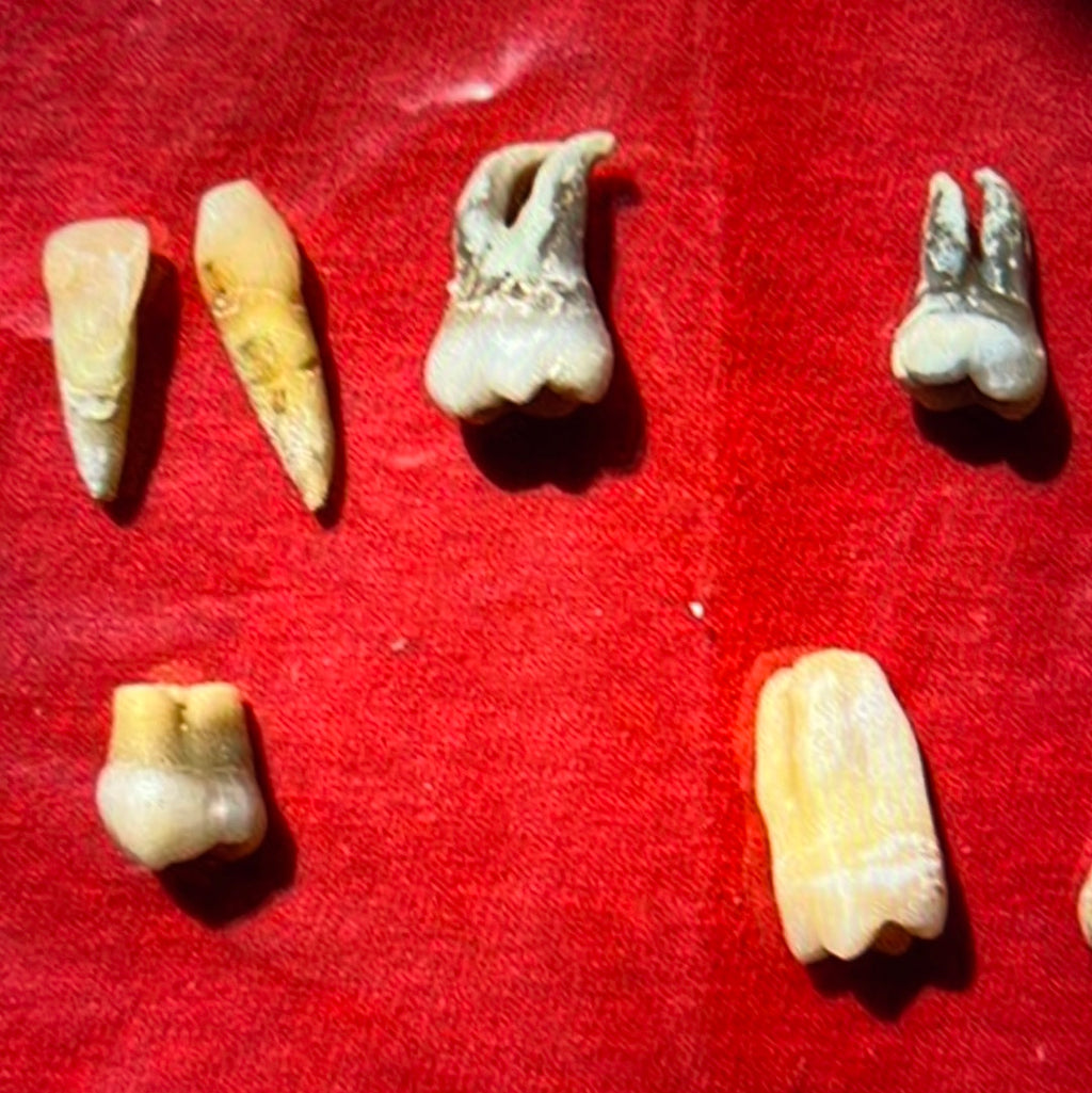 Approximately 474 Natural Teth In A Jar Molars Premolars Incisors For Research Practice OpRCT Ebay Inv