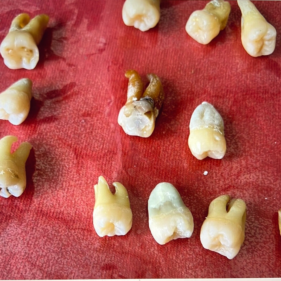 Approximately 482 Natural Teeth In Jar Molars Research Practice OpRCT ENDO