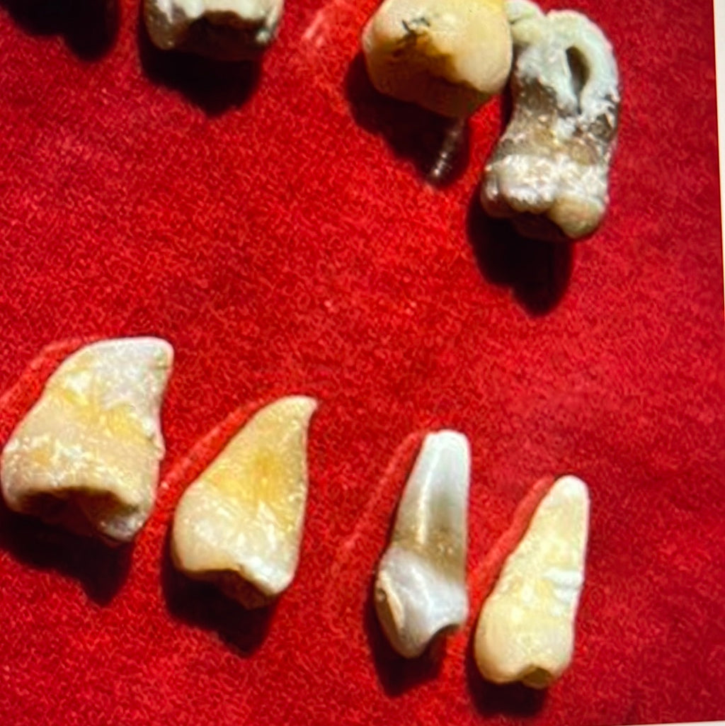 Approximately 474 Natural Teth In A Jar Molars Premolars Incisors For Research Practice OpRCT Ebay Inv