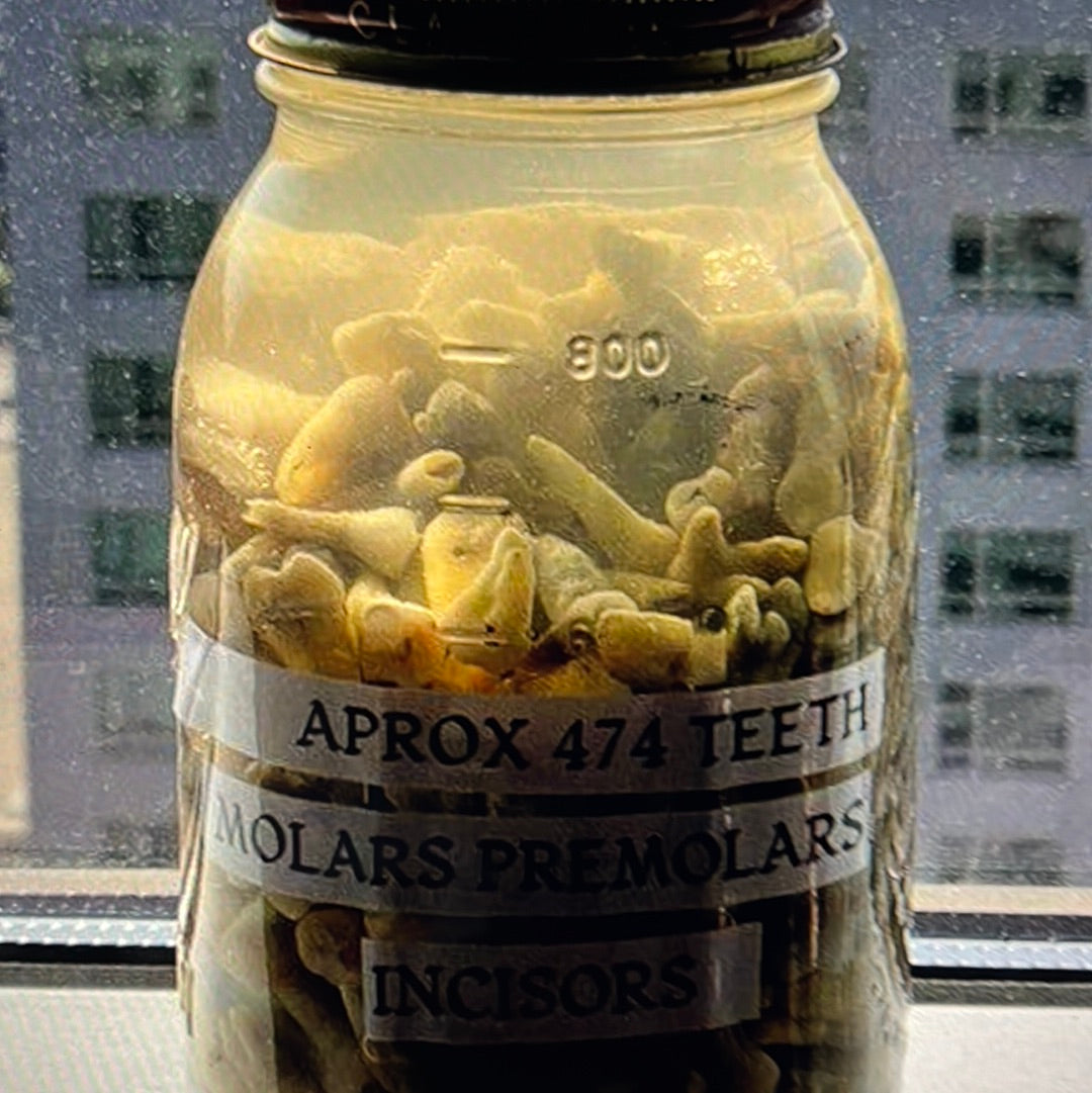 Approximately 474 Natural Teth In A Jar Molars Premolars Incisors For Research Practice OpRCT Ebay Inv