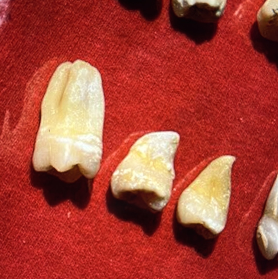 Approximately 474 Natural Teth In A Jar Molars Premolars Incisors For Research Practice OpRCT Ebay Inv