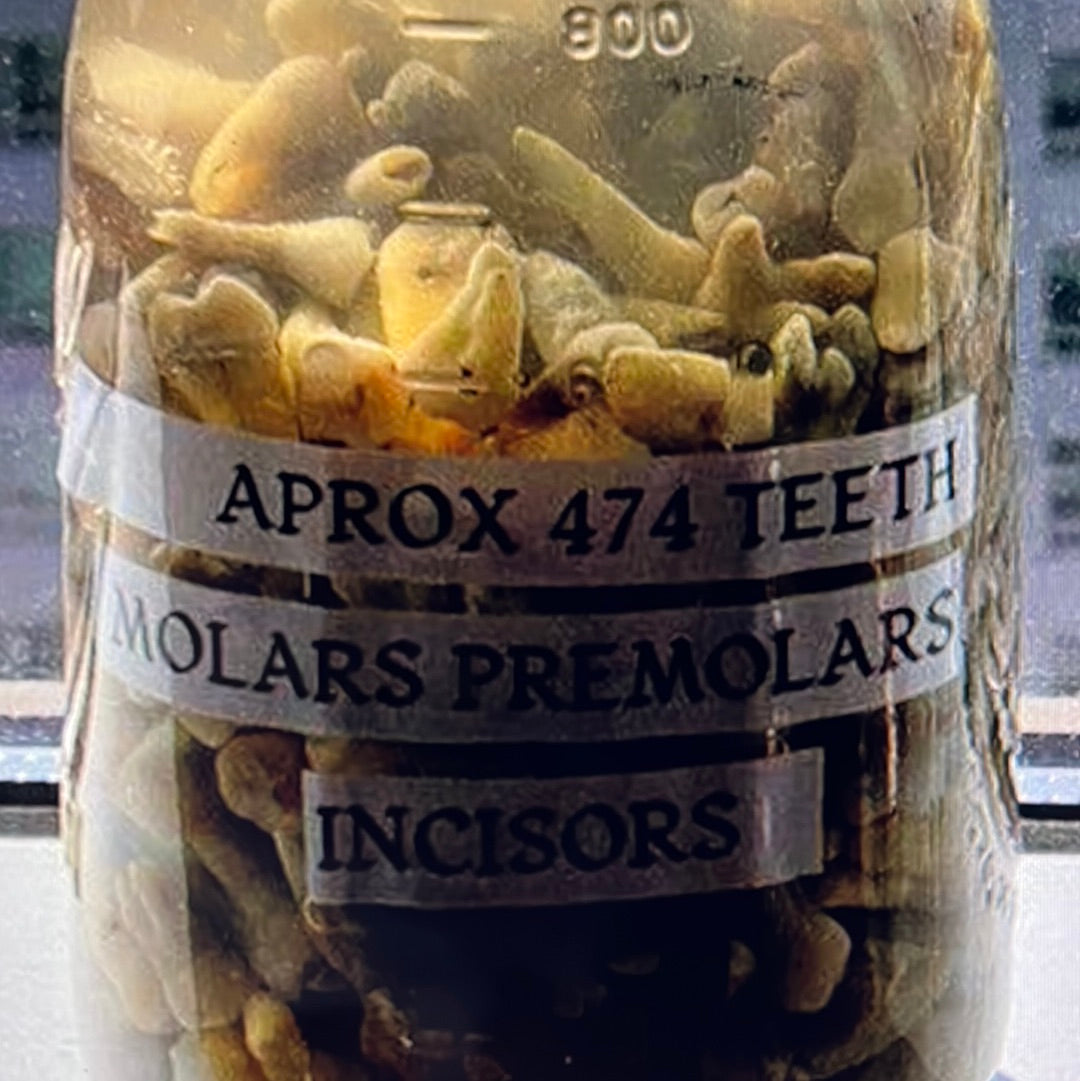 Approximately 474 Natural Teth In A Jar Molars Premolars Incisors For Research Practice OpRCT Ebay Inv