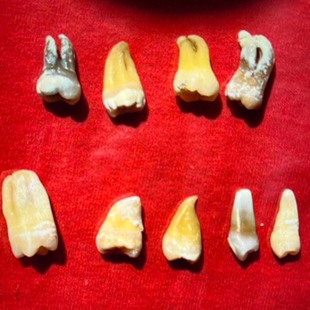 Approximately 474 Natural Teth In A Jar Molars Premolars Incisors For Research Practice OpRCT Ebay Inv