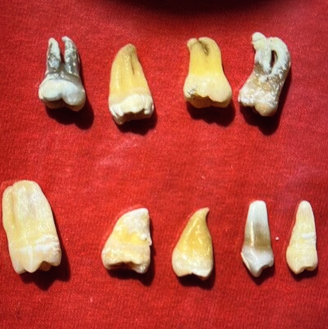 Approximately 474 Natural Teth In A Jar Molars Premolars Incisors For Research Practice OpRCT Ebay Inv